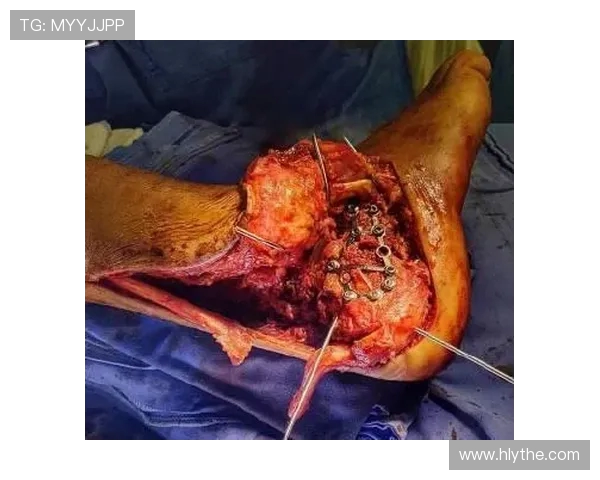 帕夫洛维奇左腿遭高强度创伤检查结果显示未骨折情况令人松一口气